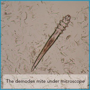 Demodex mite under microscope